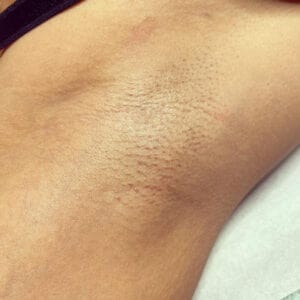 Gentle and Natural Armpit Waxing in Knoxville, TN - The Babe Cave - Waxing and Skin Care